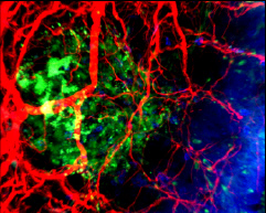Neuroimmune interactions in the gut